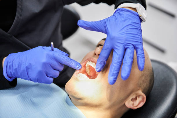 Best Broken or Chipped Tooth Repair in Mineral Ridge, OH